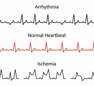 Heart Rate