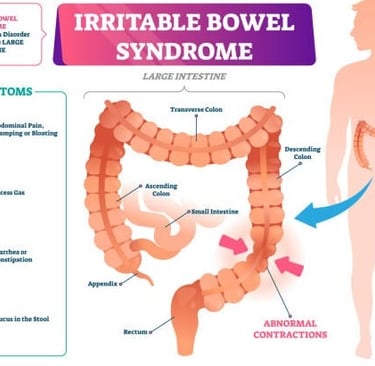 irritable bowel syndrome