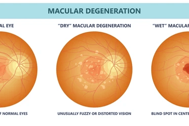 macula