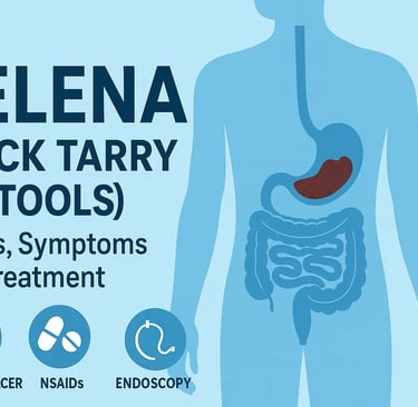 Illustration of melena showing black tarry stools caused by upper gastrointestinal bleeding,