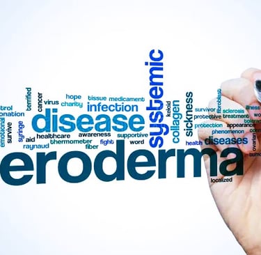 Understanding Scleroderma