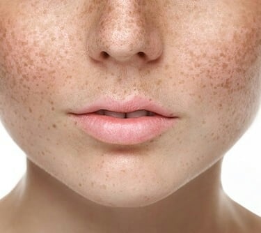 ANTI-PIGMENTATION, AGE SPOT TREATMENT Dagenham