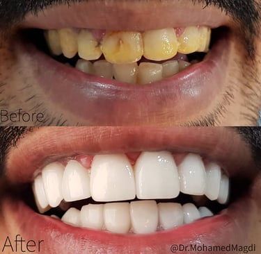 دكتور اسنان في الكويت