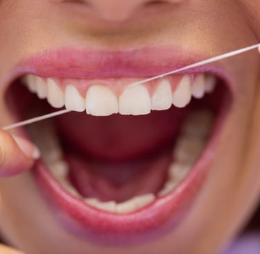 Why Flossing is Important