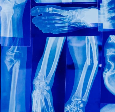 Xray dataset