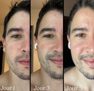 Le témoignage en images de Guillaume Aptouche sur HL Skin, gamme de soins pour le visage Herbalife, 
