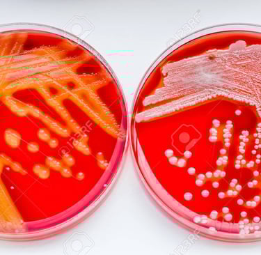 meio de cultura ágar MacConkey identificando streptococcus e staphylococcus