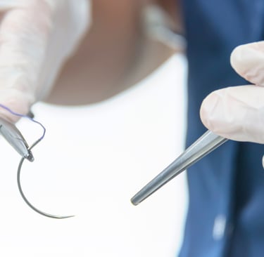 error médico cardiología -olvidaron una aguja en el corazón 