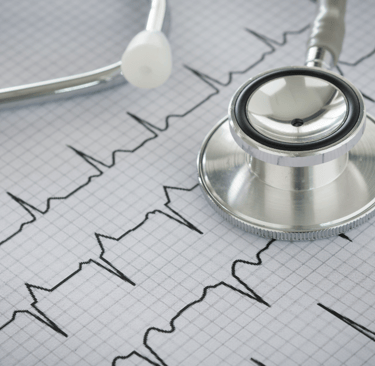 cardiología -negligencia médica en infarto