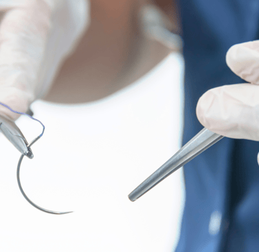 torsión testicular y ovárica