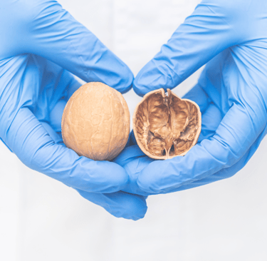negligencia por no diagnosticar torsión testicular