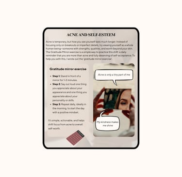 Digital guide titled 'The Ultimate Acne Guide: A holistic approach to healing and accepting acne'.