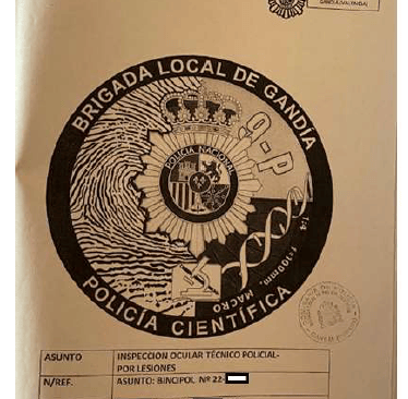 La policía científica de Gandía no supo o no pudo hacer su trabajo