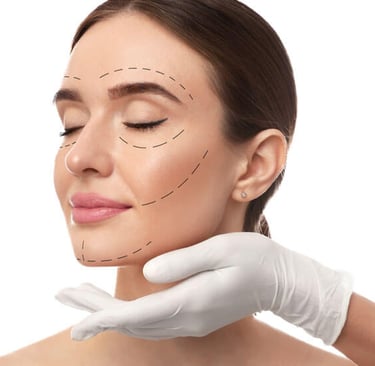 Armonización facial femenina con ácido hialurónico para equilibrar facciones y rejuvenecer el rostro