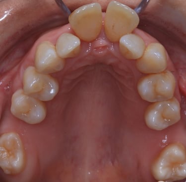 pictures of teeth