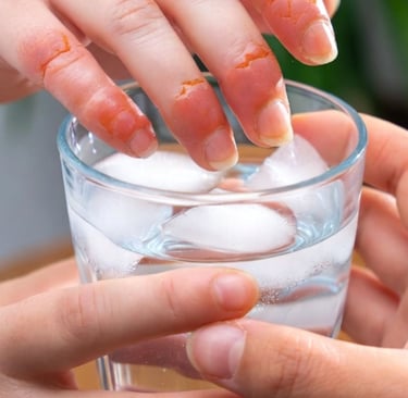 _ Fight Painful Digital Ulcers with Fasting and Cold Water image