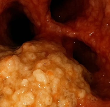  Vomiting and Obstructions in the Upper Gastrointestinal Tract 🔬  