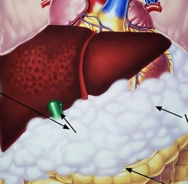 ❤️ The Fat You Can’t See: How Visceral Fat Damages the Heart & Metabolism every thing