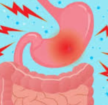 Emesis and Upper Digestive Tract Blockages
