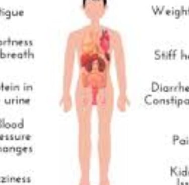 amylodosis all over the body