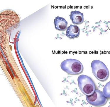 abnormal plasma cells