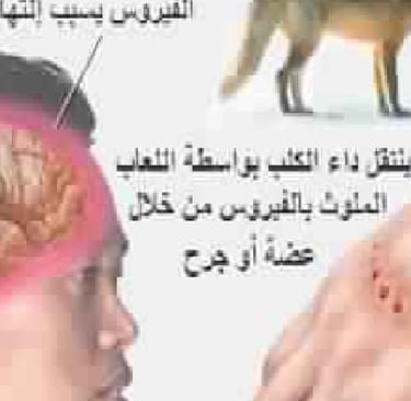 يسبب التهاب المخ