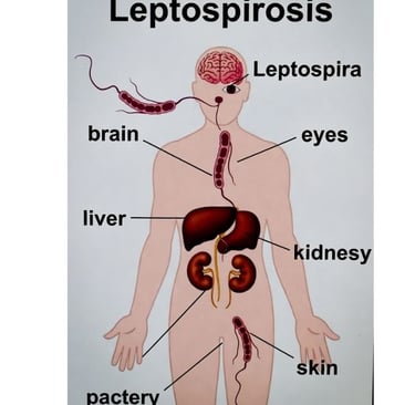 ⚖️ 🥣 🌙 داء اللولبية النحيفة : من أعراض "ألم الساق" إلى مخاطر داء ويل.. هل الصيام مفيد؟ ⏳ 🚫