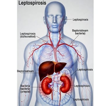 ⚖️ 🥣 🌙 داء اللولبية النحيفة : من أعراض "ألم الساق" إلى مخاطر داء ويل.. هل الصيام مفيد؟ ⏳ 🚫