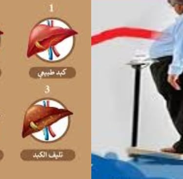 السمنة عامل الخطر الاكبر