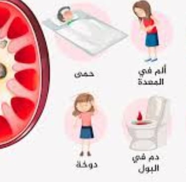 انسداد الحصوة الاعراض