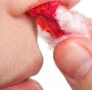 الآلية الدقيقة لعمل العسل في وقف نزيف الأنف الخلفي لا تزال غير موثقة علميًا بشكل كامل توقف الد