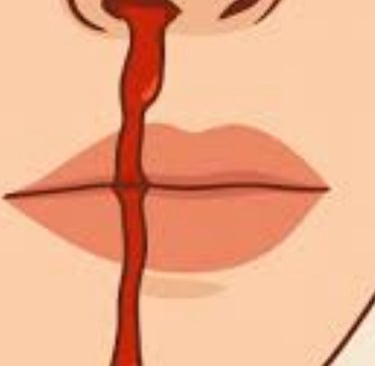 الآلية الدقيقة لعمل العسل في وقف نزيف الأنف الخلفي لا تزال غير موثقة علميًا بشكل كامل توقف الد