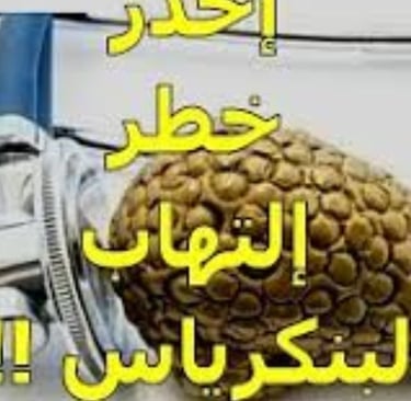 النهاب البنكرياس
