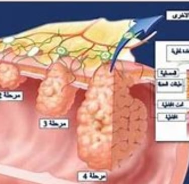 فيمكن أن يكون طفيفًا أو موجعًا أو حادًّا أو حارقًا. ويمكن أن يكون ثابتًا أو متقطعًا أو معتدلًا أو مت