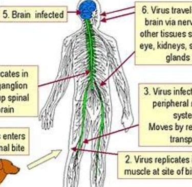 brain infection