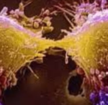 Fasting in Tumor Lysis Syndrome