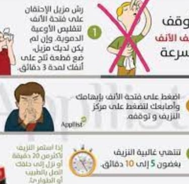 اوقف النزفكيف تدير نزيف الانف :علاج نزيف الانف الخلفي بالعسل والمضمضة