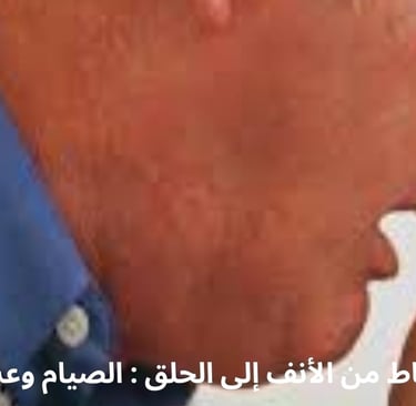 أتحدى العالم على طريقة دكتور حسن علاج التهاب الحلق