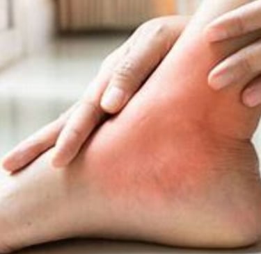 #الصيام_الطوعي #الجفاف #تجلط_الدم #الصيام_العلاجي #الطب_النبوي #الطب_الطبيعي #HKEM #DrHassanAlwarraq