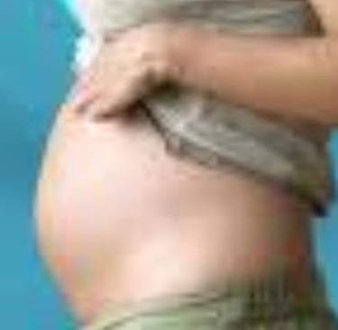 Abdominal Distension Aray of managements