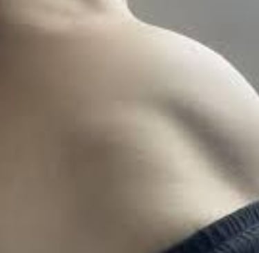 Abdominal Distension fasting
