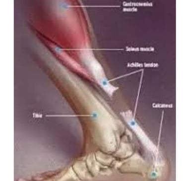 Achilles Tendon Injury Broad Overviews