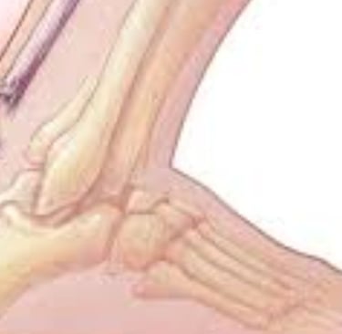 Achilles Tendon Injury : Broad Overviews