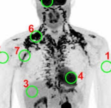 ❄️Accurate Evaluating Brown Adipose Tissue