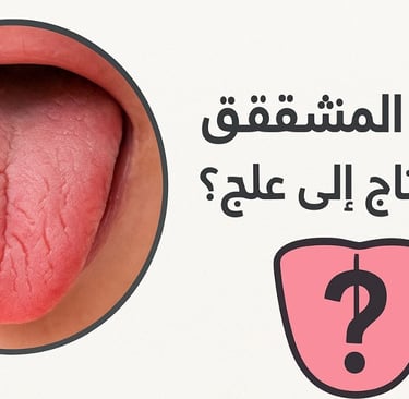 ⚕️🌿 اللسان المتشقق هل يحتاج إلى علاج؟👅❓ (2)