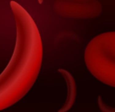 ⚔️🧠 When Fasting Helps—or Hurts—in Sickle Cell Crises