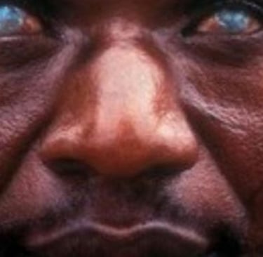 blindness