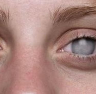 blindness