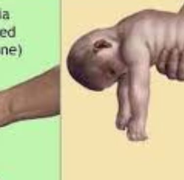 hypotonia