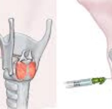 injection for laryngeal spasm